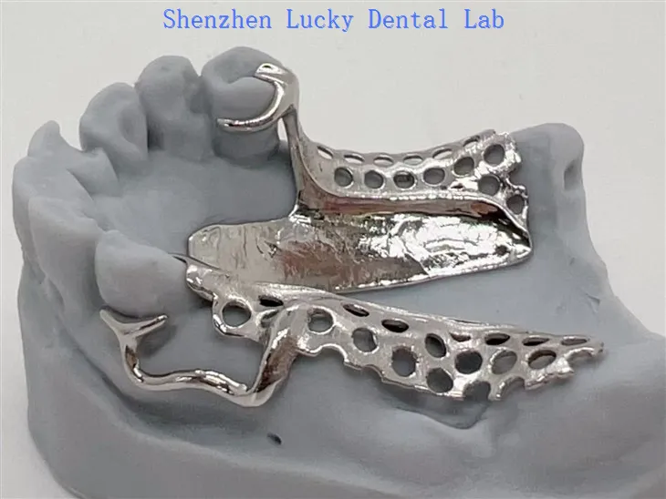 3D Print Dental Cocr Metal Framework