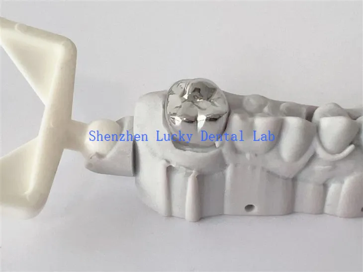 3D Print Dental COCR Mahkota Full Metal