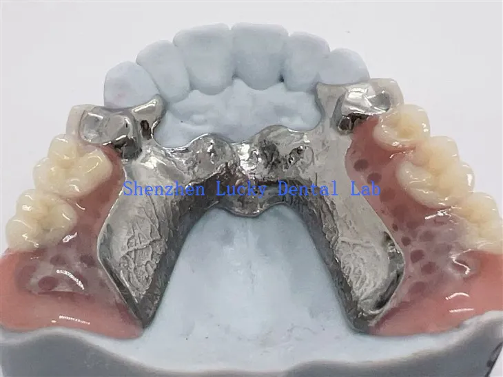 Kerangka Paduan Titanium Cetak 3D