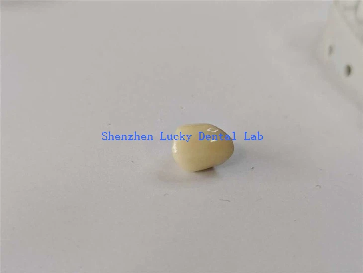 Lab Crown China Dental Pfm Co Cr Crown