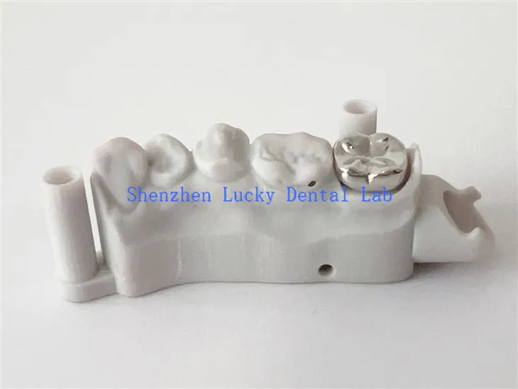 China tinggi cetak 3D Dental full metal mahkota