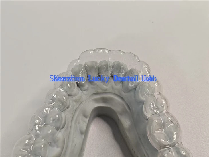 Clear Teeth Straightening Orthodontic