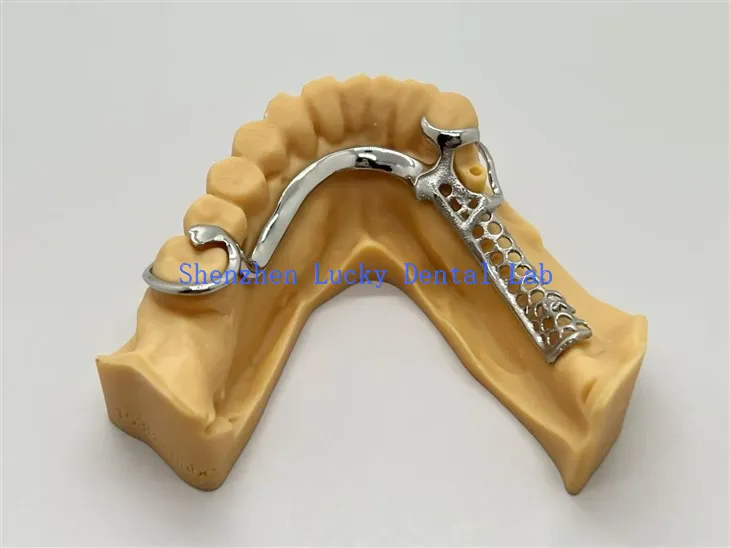 Kerangka Cobalt Chrome