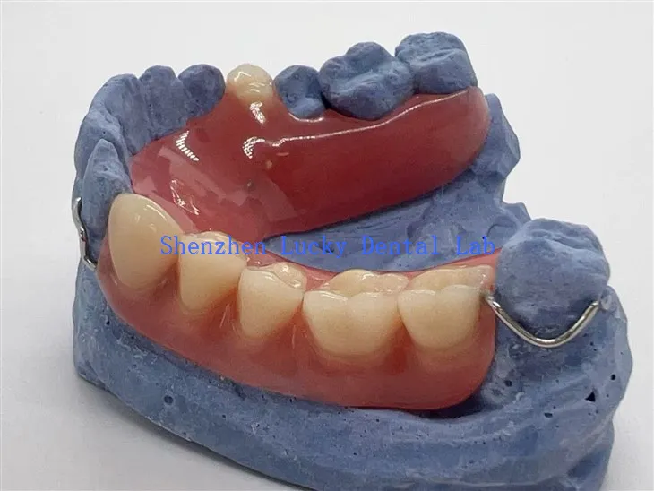 Gigitiruan akrilik parsial yang nyaman dengan jepitan kawat