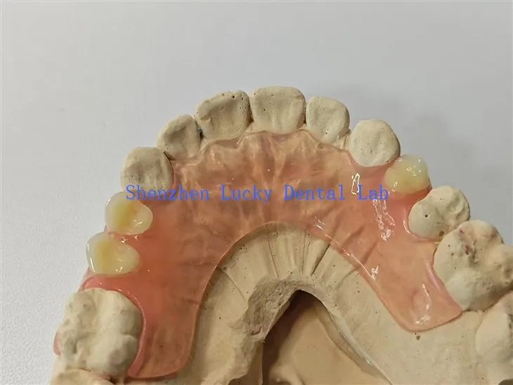 Lab gigi gigitiruan fleksibel yang nyaman
