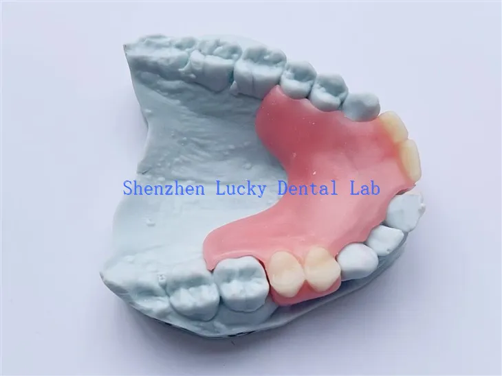 Cobalah gigitiruan fleksibel parsial gigi yang disesuaikan di produsen