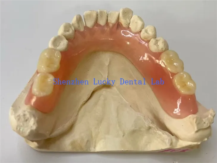 Lab gigi gigitiruan fleksibel parsial