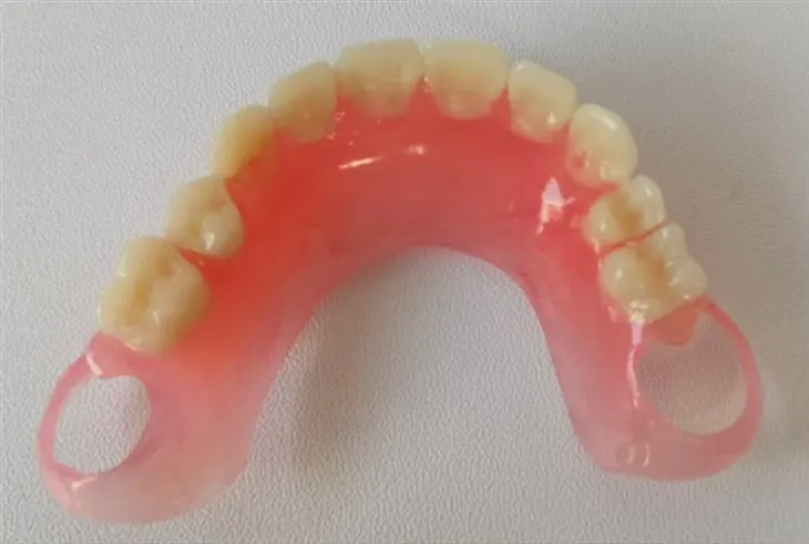 Valplast berkualitas tinggi gigi dengan lab desain jendela