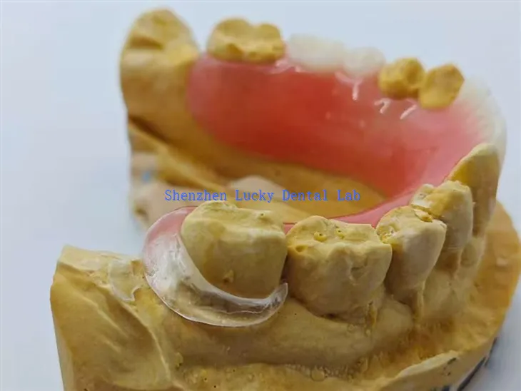 Gigitiruan akrilik dengan jepitan bening