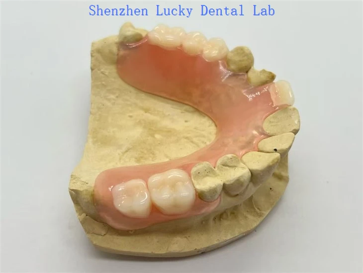 Basis Resin Fleksibel Dengan Gesper Fleksibel