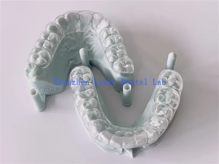 Lab Gigi Penjaga Malam Occlusal yang Keras
