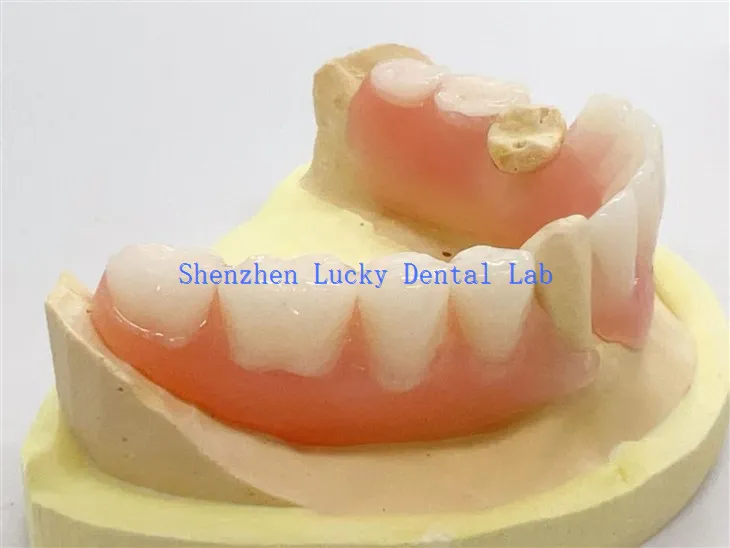 Gigitiruan fleksibel parsial gigi berkualitas tinggi